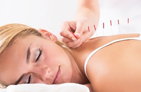 Acupuncture Treatment