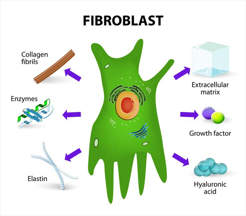 Fibroblast